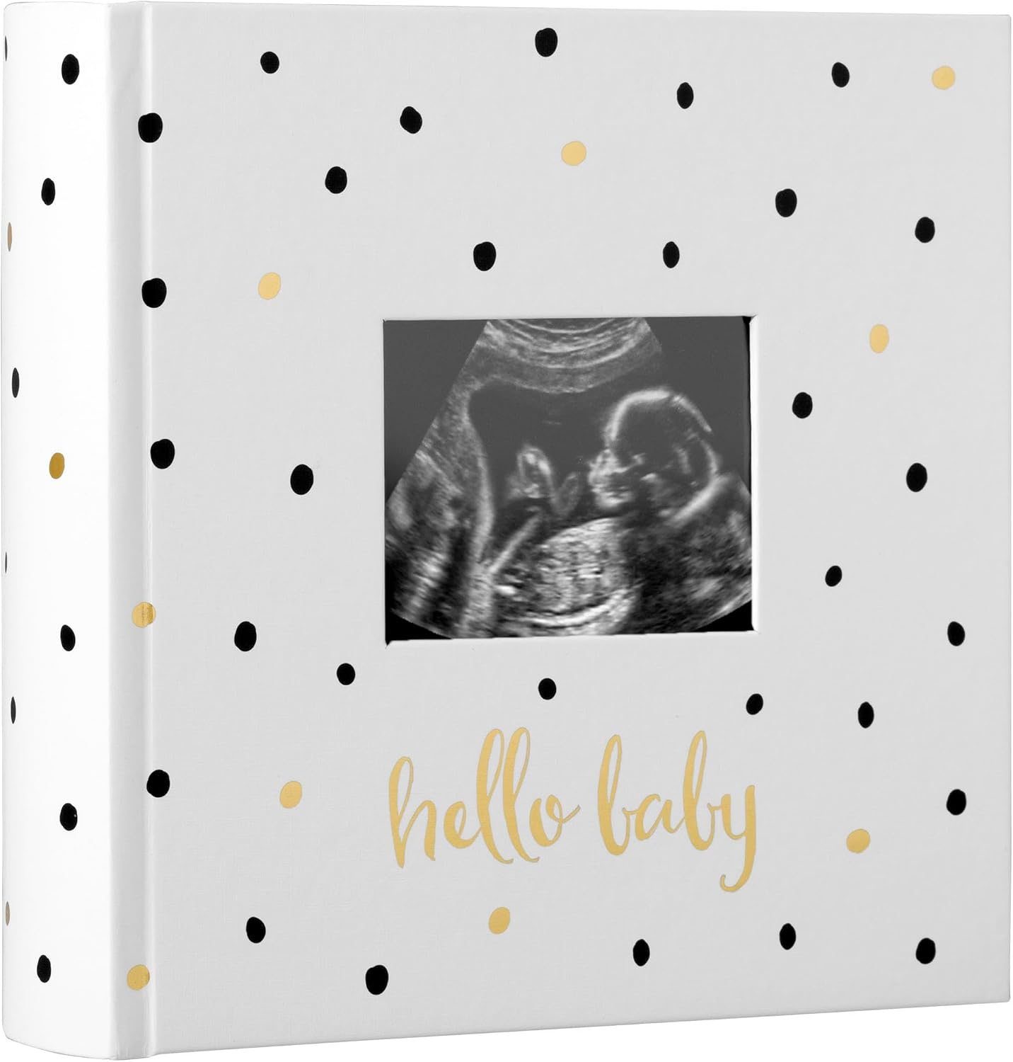 Hello Baby Fotoğraf Albümü, Yeni ve Bekleyen Ebeveynler için Bebek Kitabı Hatırası, Cinsiyetsiz Bebek Aksesuarı, 200 Fotoğraf Tutar, Siyah ve Altın Puantiyeli