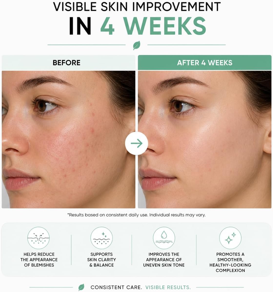 Azelaik Asit Serumu Niacinamide & Çinko ile 30ml
