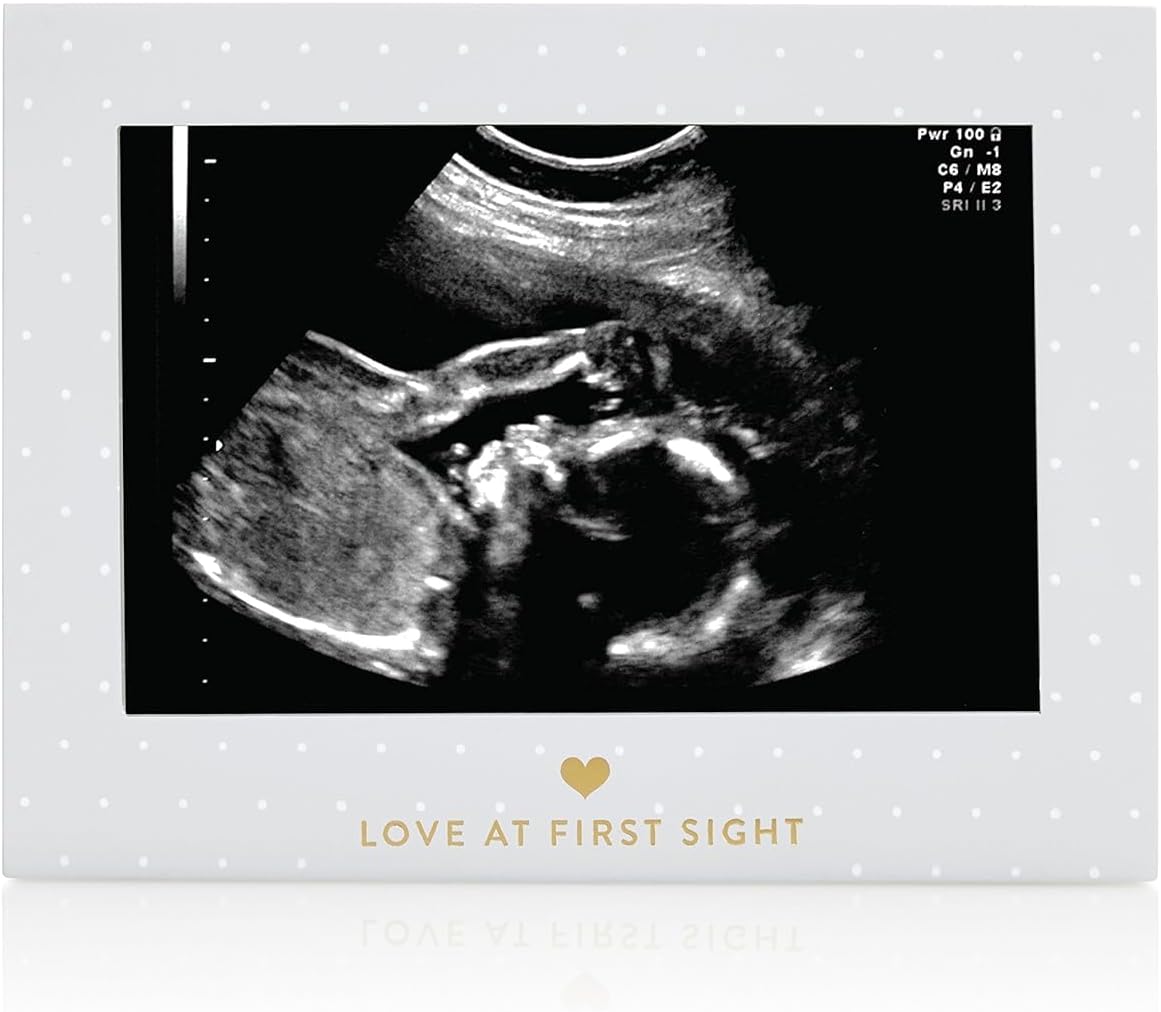 Sonogram Resim Çerçevesi Hamilelik Hatırası, Yakında Kız Bebek veya Erkek Bebek Olacak Cinsiyetsiz Çocuk Odası Dekoru