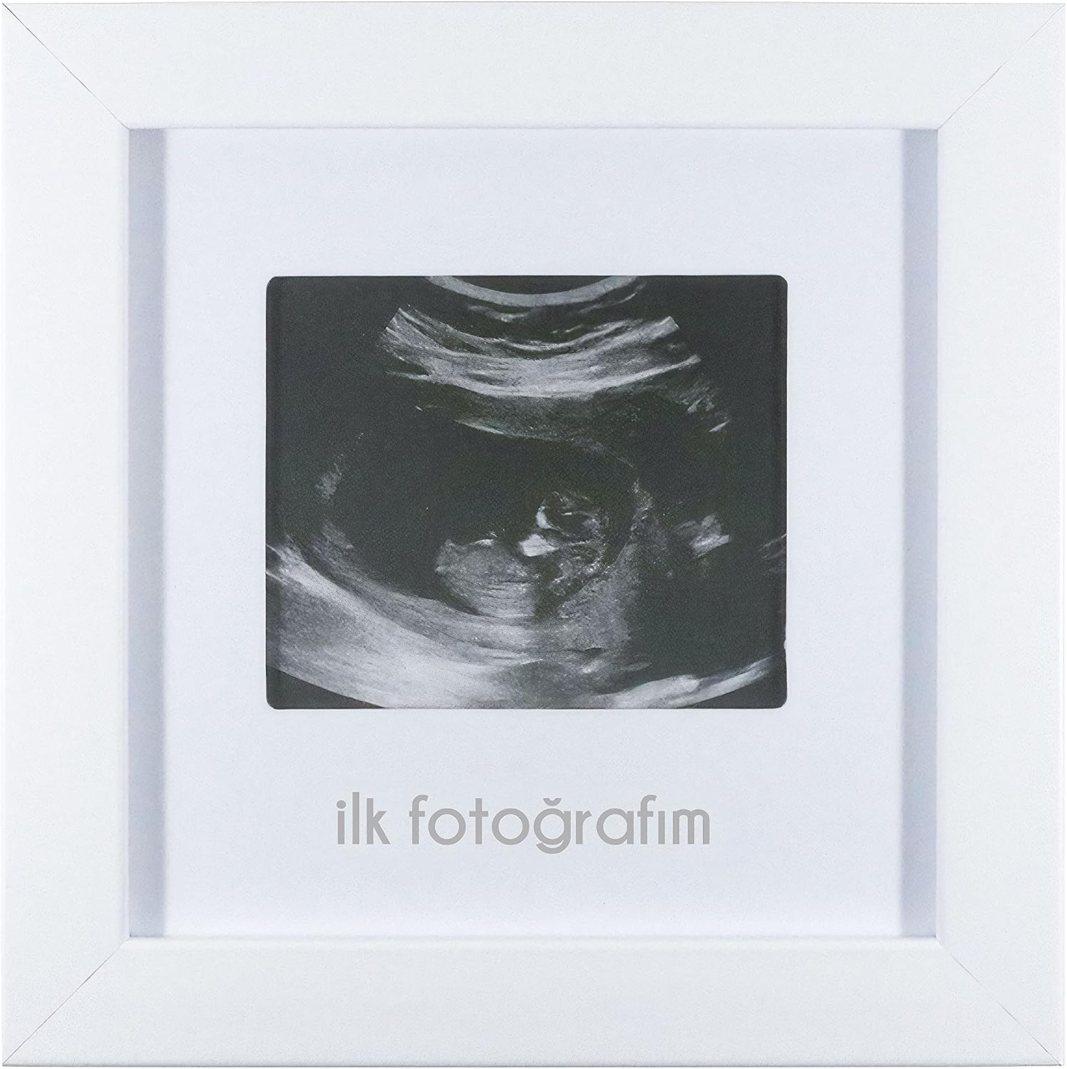 İlk Fotoğrafım Bebek Ultrason Çerçevesi - Bebek Odası Resim Anı Çerçevesi