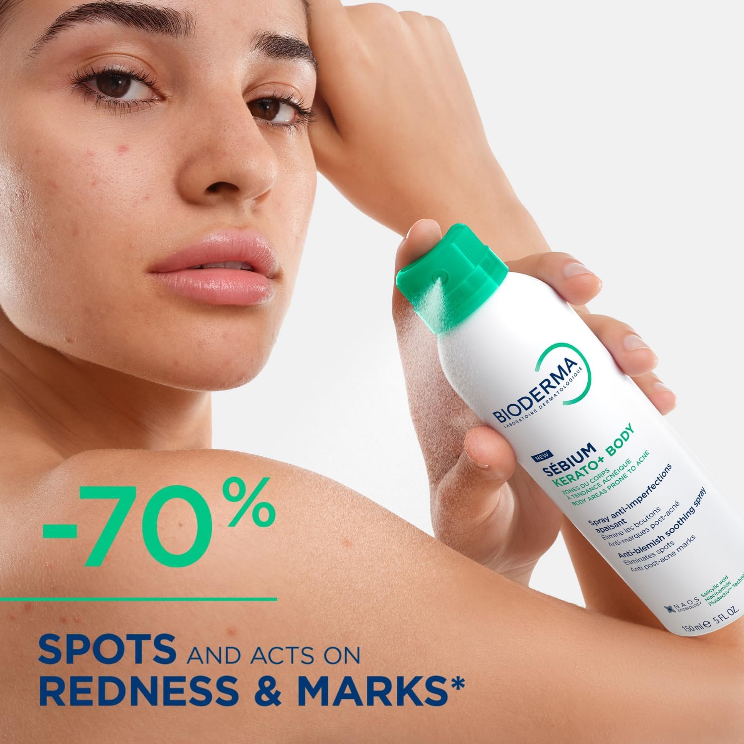 Sebium Kerato+ Body Sivilce ve Akne Lekesi Karşıtı Ferahlatıcı Vücut Spreyi 150 ml