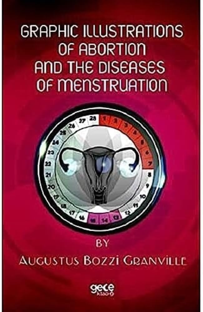Graphic Illustrations Of Abortion And The Diseases Of Menstruation