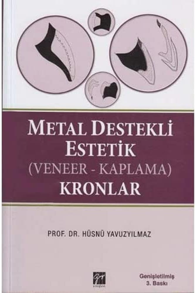 Metal Destekli Estetik (Veneer-Kaplama) Kronlar